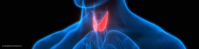 3D-Illustration der Schilddrüsenlappen im Kehlkopf eines Mannes mit der Autoimmunerkrankung Hashimoto-Thyreoiditis