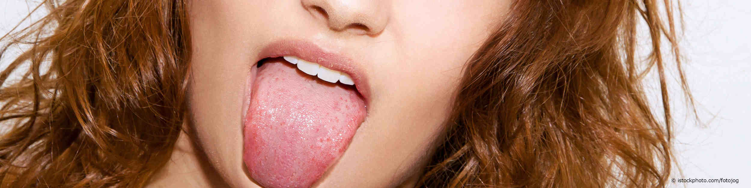 Junge Frau streckt ihre belegte Zunge heraus.