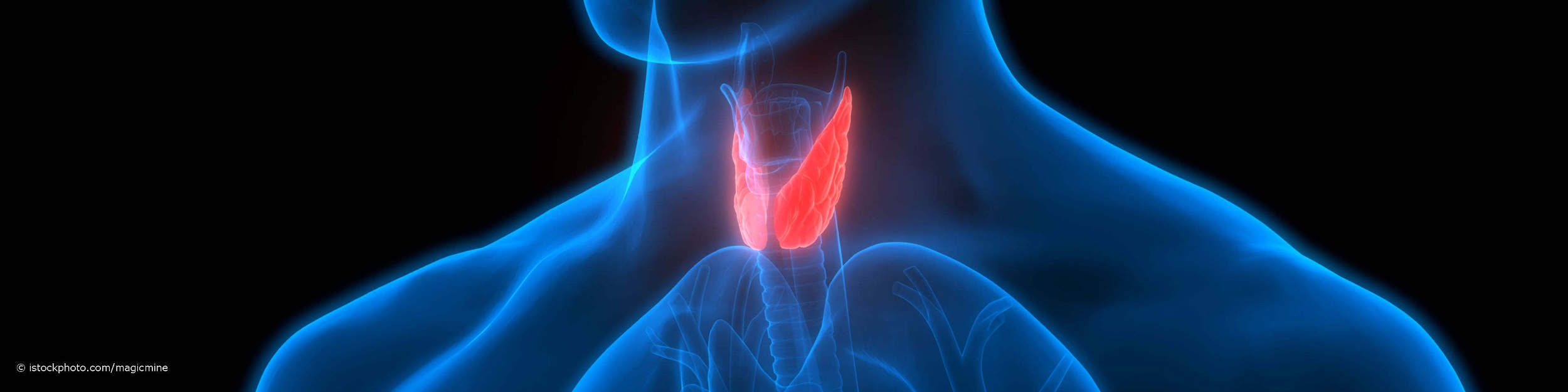 3D-Illustration der Schilddrüsenlappen im Kehlkopf eines Mannes mit der Autoimmunerkrankung Hashimoto-Thyreoiditis